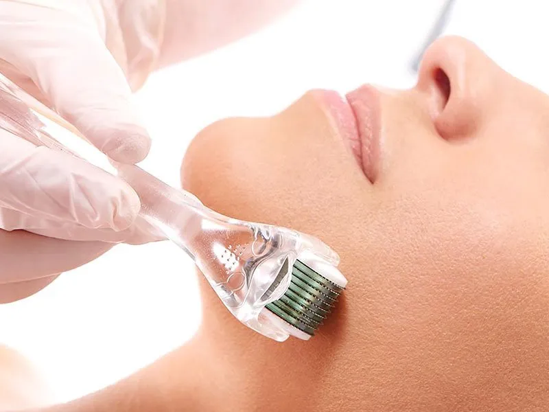 Microneedling Therapy service