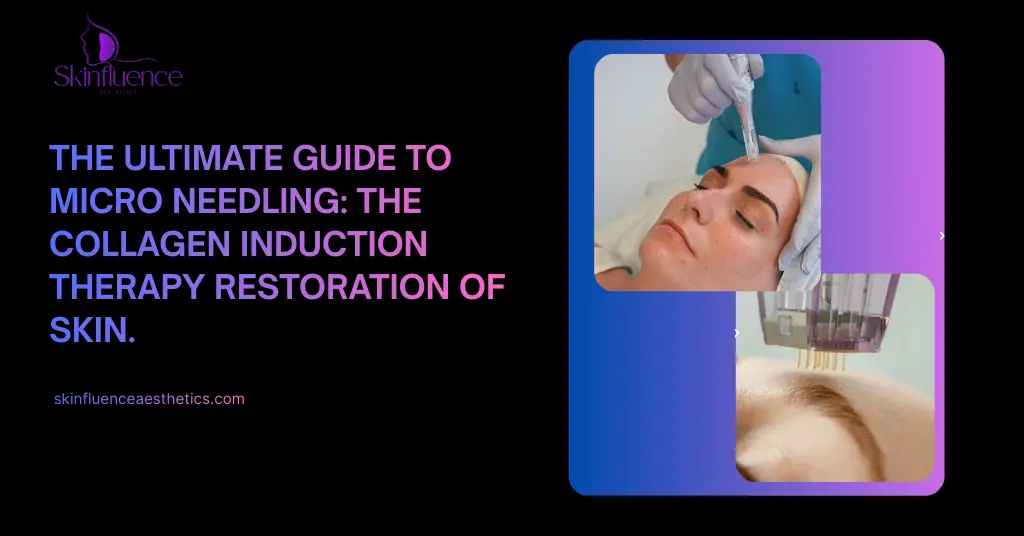 he ultimate guide to micro needling: The collagen induction therapy restoration of skin." Two images show close-ups of micro needling treatments on the face. The design uses a purple and blue gradient background with the Skinfluence logo and website URL.