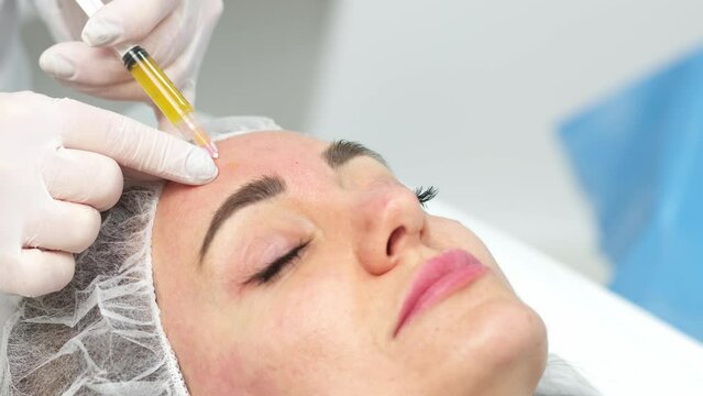 Microneedling PRP Facial at Skinfluence Aesthetics to enhance collagen and improve skin texture