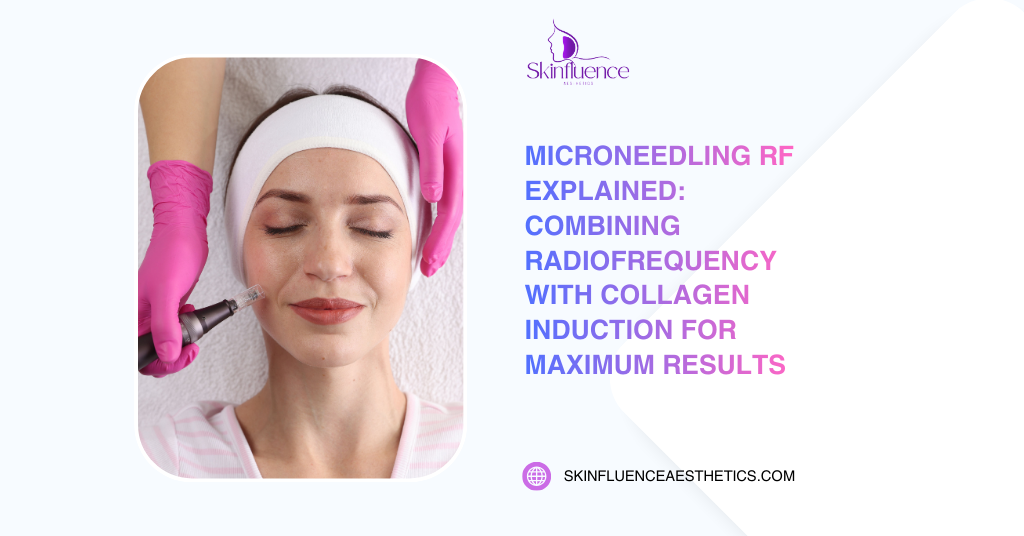 Woman receiving RF microneedling treatment with radiofrequency device to stimulate collagen induction for skin rejuvenation at Skinfluence Aesthetics.
