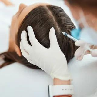 PRP hair restoration scalp injections for thinning hair at Skinfluence Aesthetics